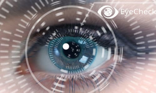 EyeCheckup-Murat_Karacorlu