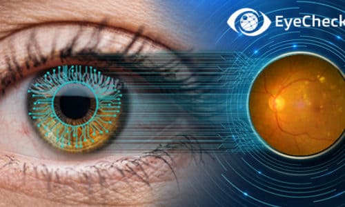Fundus diyabetik retinopati EyeCheckup