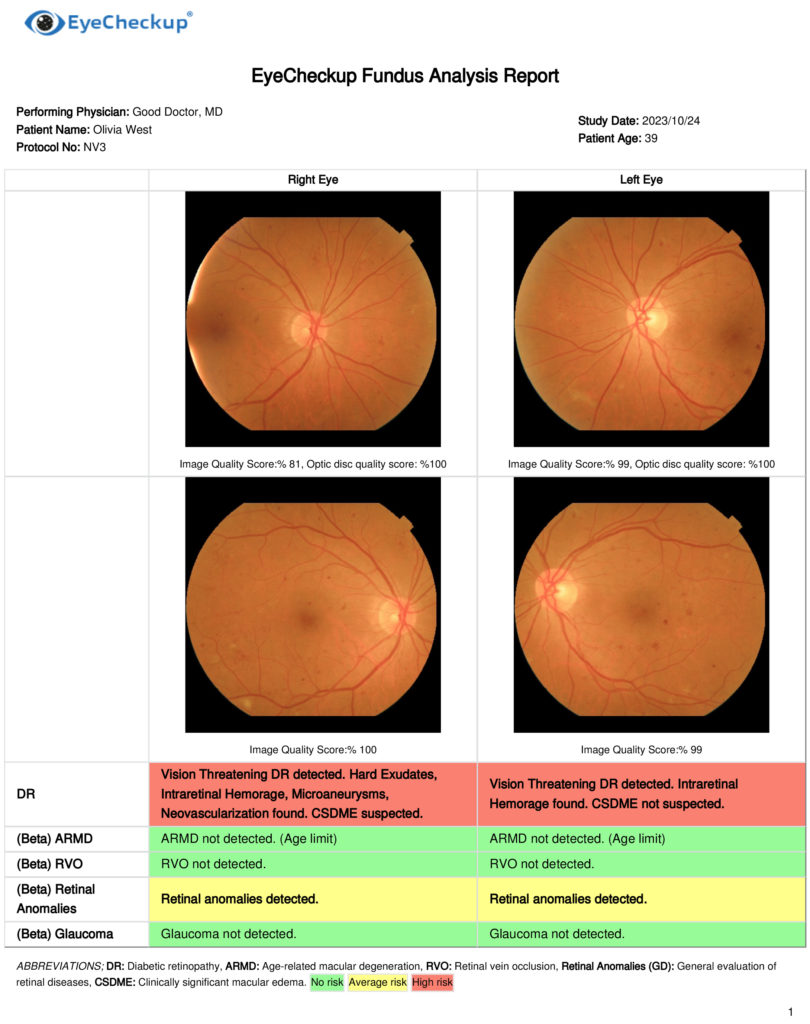 EyeCheckup rapor